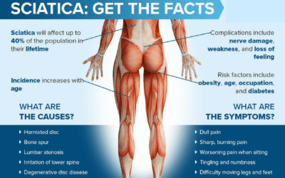 How Long Does Sciatica Last?